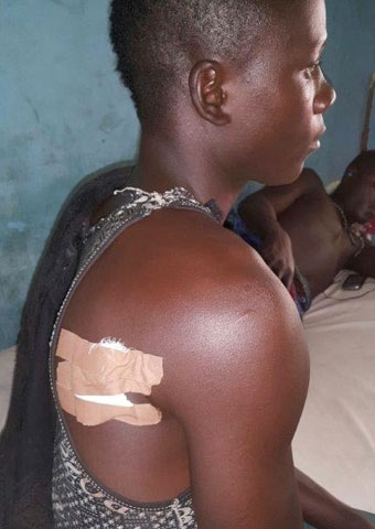 A victim is being treated in a hospital after more than 1,000 armed men attacked a Christian village on Jan. 28 in Taraba State, Nigeria.