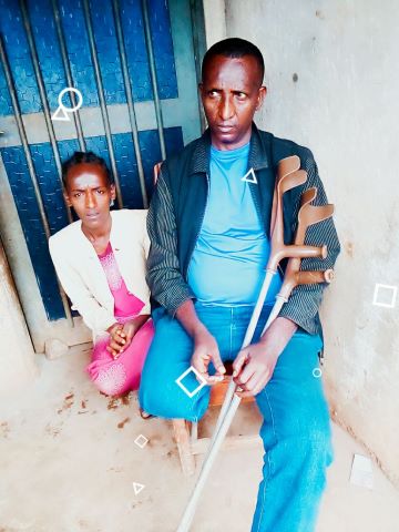 Tilahun lost his leg in when he was attacked for his Christian faith.